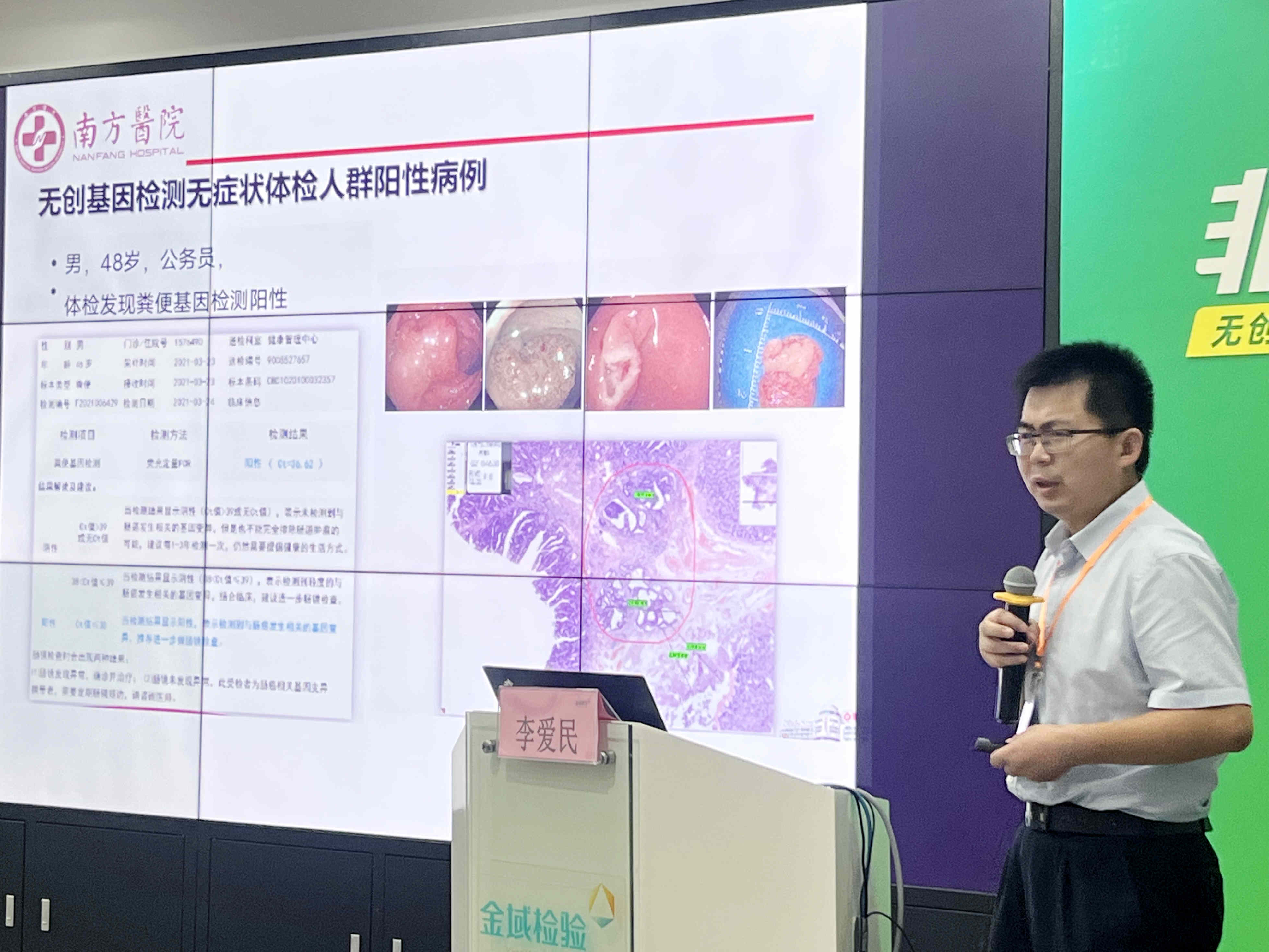 李愛民教授主題報告《結(jié)直腸的篩查與早期診治》